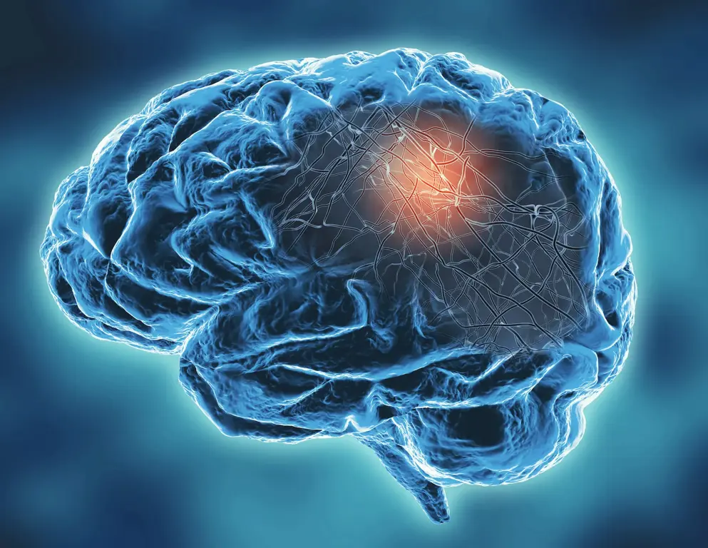3D scan of a brain