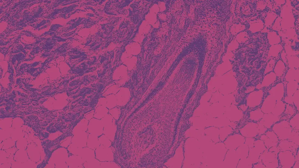 Scalp and hair follicles of human under the microscope , pink and purple colours